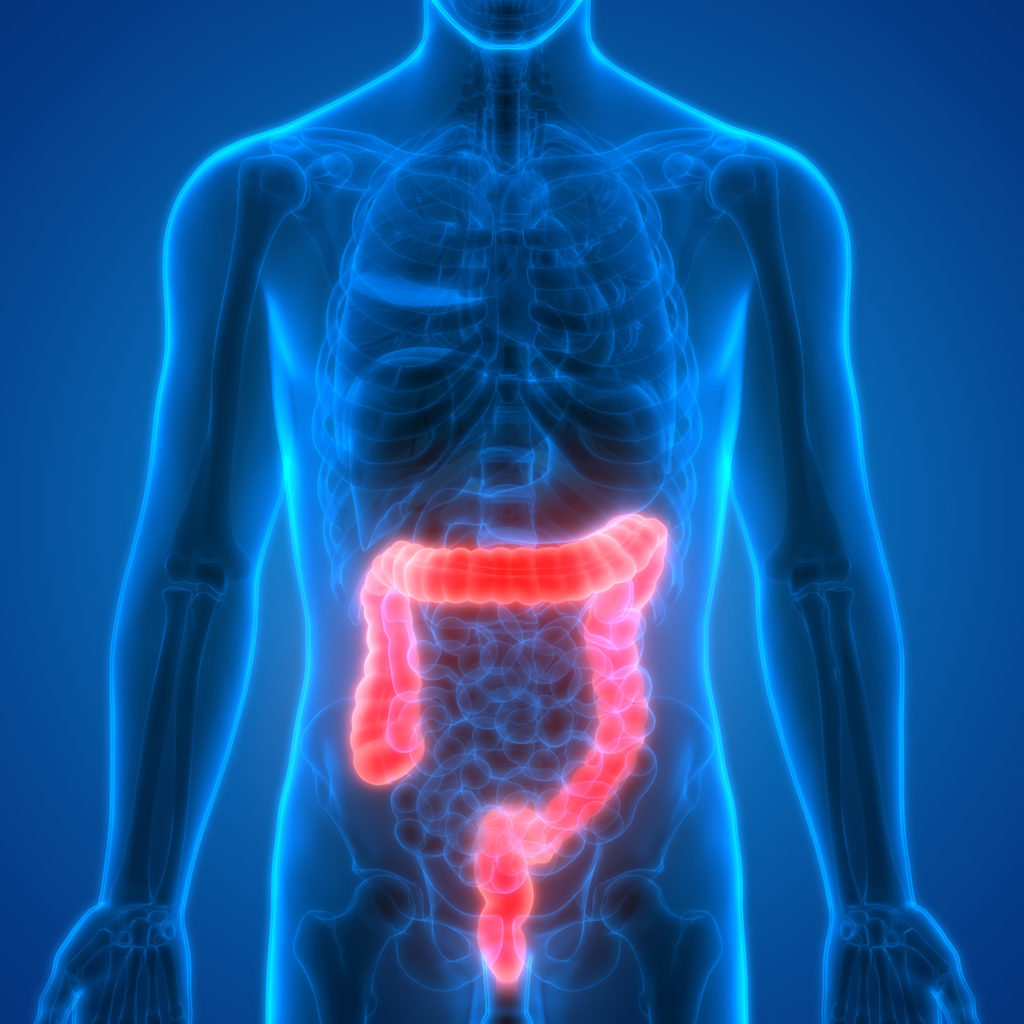 Colorectal cancer / Carcinoma of the colon – maintrac