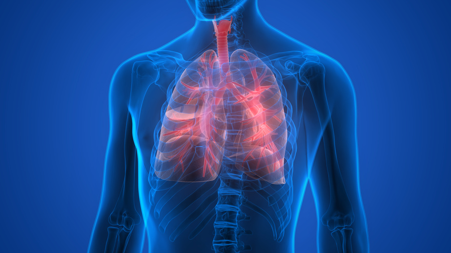 Lung cancer / Bronchial carcinoma maintrac